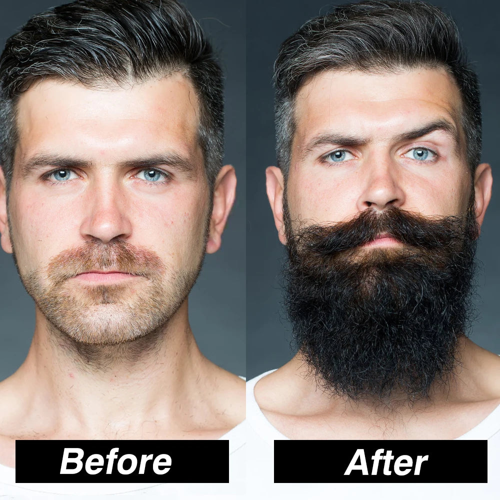 Beard Growth Kit For Men Grooming Basics