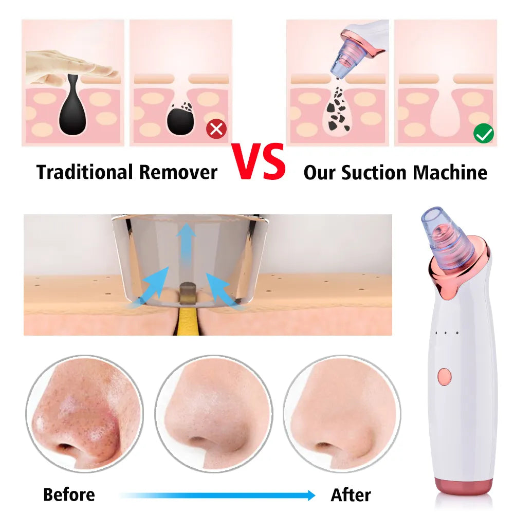 Facial Blackhead Remover Electric Acne Cleaner Grooming Basics