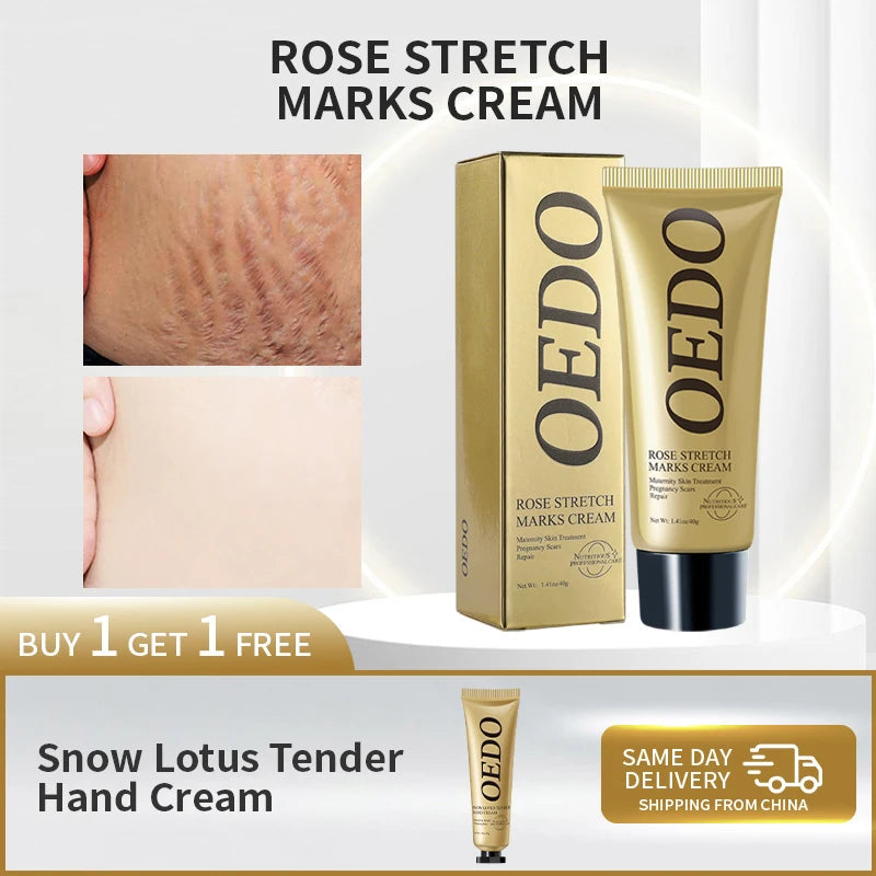 Rose Removes Stretch Mark Cream Grooming Basics